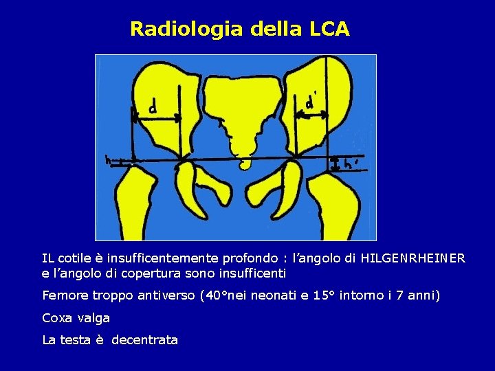 Radiologia della LCA IL cotile è insufficentemente profondo : l’angolo di HILGENRHEINER e l’angolo