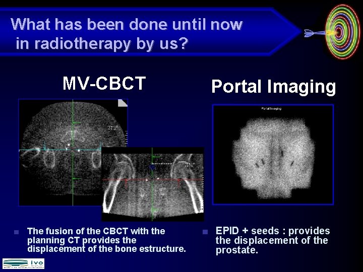 What has been done until now in radiotherapy by us? MV-CBCT ■ The fusion