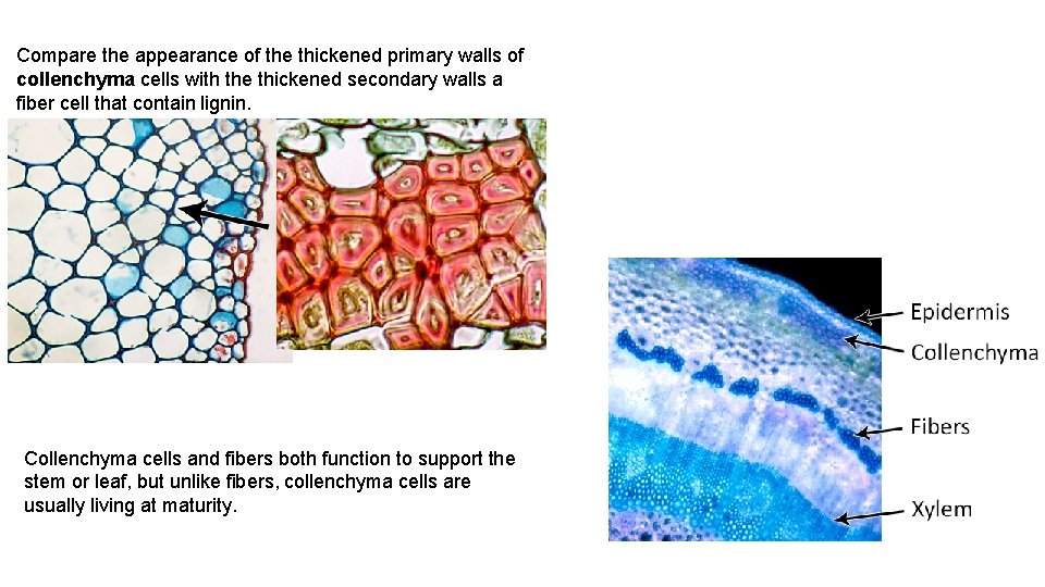 Compare the appearance of the thickened primary walls of collenchyma cells with the thickened