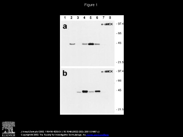 Figure 1 J Invest Dermatol 2002 118416 -423 DOI: (10. 1046/j. 0022 -202 x.