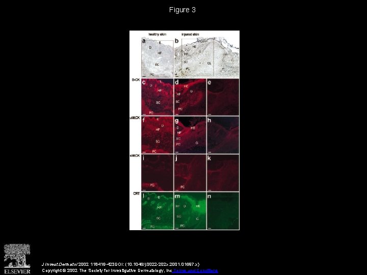 Figure 3 J Invest Dermatol 2002 118416 -423 DOI: (10. 1046/j. 0022 -202 x.