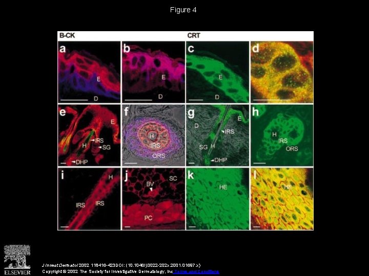 Figure 4 J Invest Dermatol 2002 118416 -423 DOI: (10. 1046/j. 0022 -202 x.