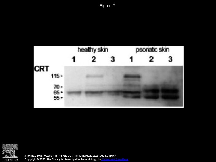 Figure 7 J Invest Dermatol 2002 118416 -423 DOI: (10. 1046/j. 0022 -202 x.