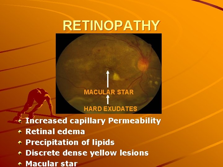 RETINOPATHY MACULAR STAR HARD EXUDATES Increased capillary Permeability Retinal edema Precipitation of lipids Discrete