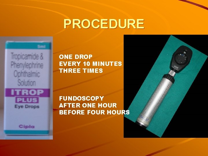 PROCEDURE ONE DROP EVERY 10 MINUTES THREE TIMES FUNDOSCOPY AFTER ONE HOUR BEFORE FOUR