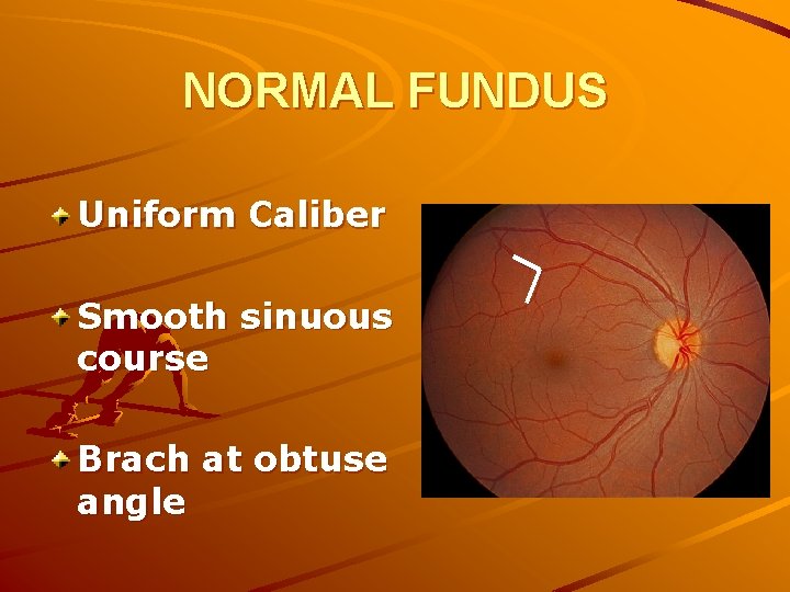 NORMAL FUNDUS Uniform Caliber Smooth sinuous course Brach at obtuse angle 