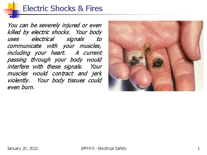 Electric Shocks & Fires You can be severely injured or even killed by electric