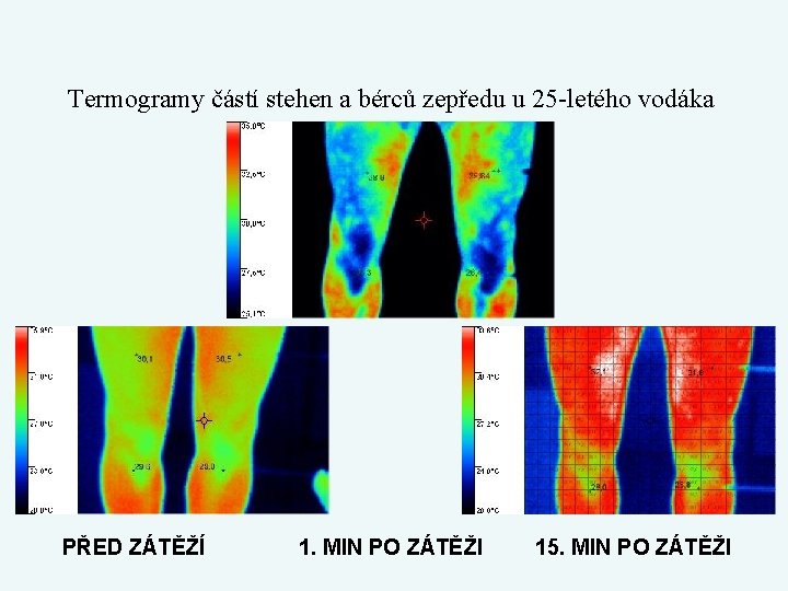 Termogramy částí stehen a bérců zepředu u 25 -letého vodáka PŘED ZÁTĚŽÍ 1. MIN