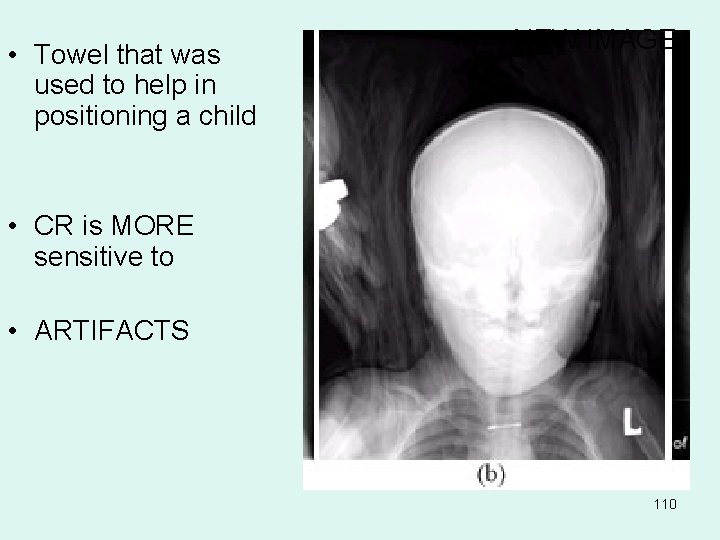  • Towel that was used to help in positioning a child NEW IMAGE