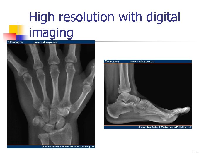 High resolution with digital imaging 112 