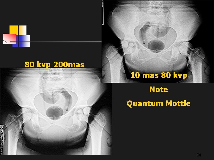 80 kvp 200 mas 10 mas 80 kvp Note Quantum Mottle 84 