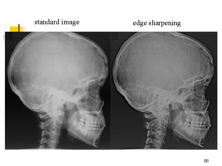 standard image edge sharpening 88 