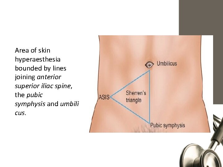 Area of skin hyperaesthesia bounded by lines joining anterior superior iliac spine, the pubic