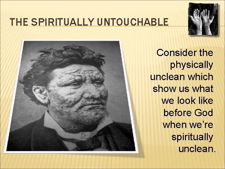 THE SPIRITUALLY UNTOUCHABLE Consider the physically unclean which show us what we look like