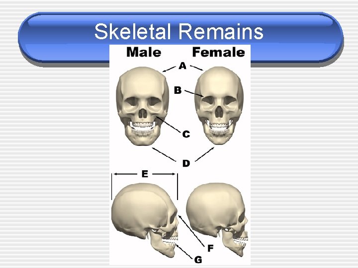 Skeletal Remains Skeletal Remains