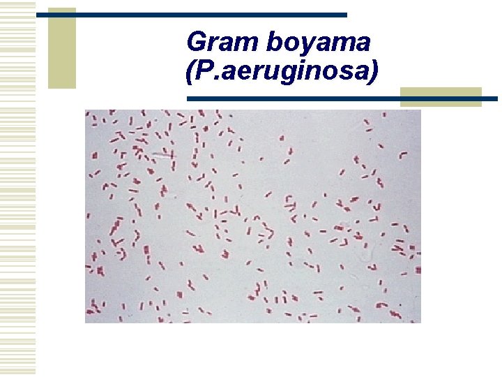 Gram boyama (P. aeruginosa) 