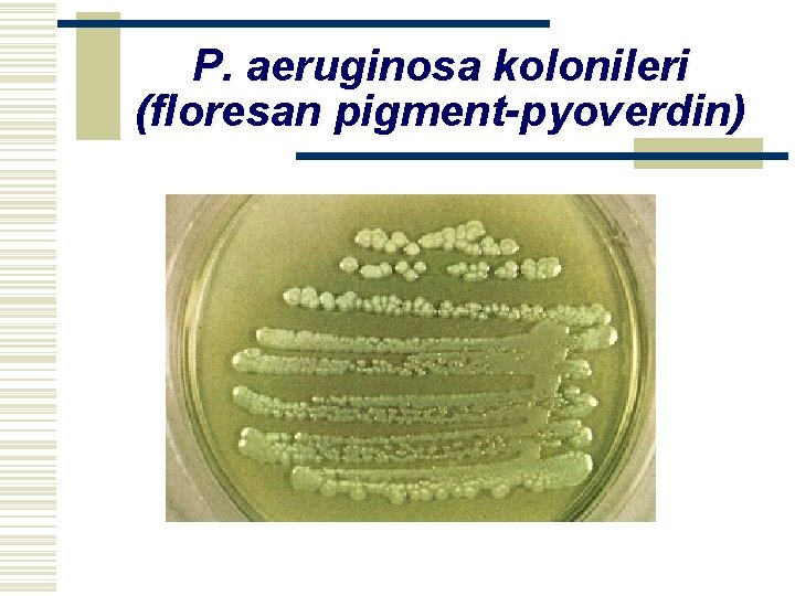 P. aeruginosa kolonileri (floresan pigment-pyoverdin) 