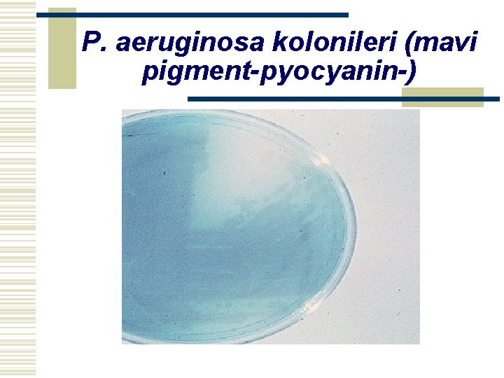 P. aeruginosa kolonileri (mavi pigment-pyocyanin-) 
