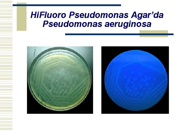 Hi. Fluoro Pseudomonas Agar’da Pseudomonas aeruginosa 