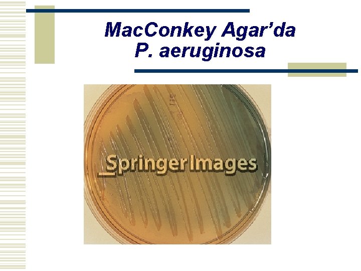 Mac. Conkey Agar’da P. aeruginosa 