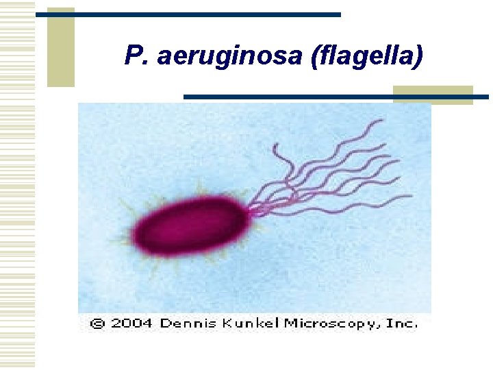 P. aeruginosa (flagella) 