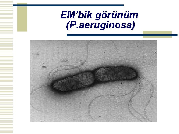 EM’bik görünüm (P. aeruginosa) 