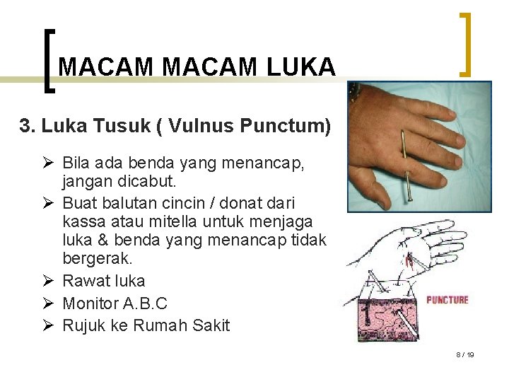 MACAM LUKA 3. Luka Tusuk ( Vulnus Punctum) Ø Bila ada benda yang menancap,