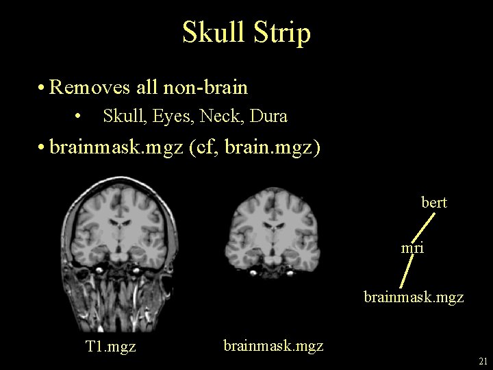 Skull Strip • Removes all non-brain • Skull, Eyes, Neck, Dura • brainmask. mgz