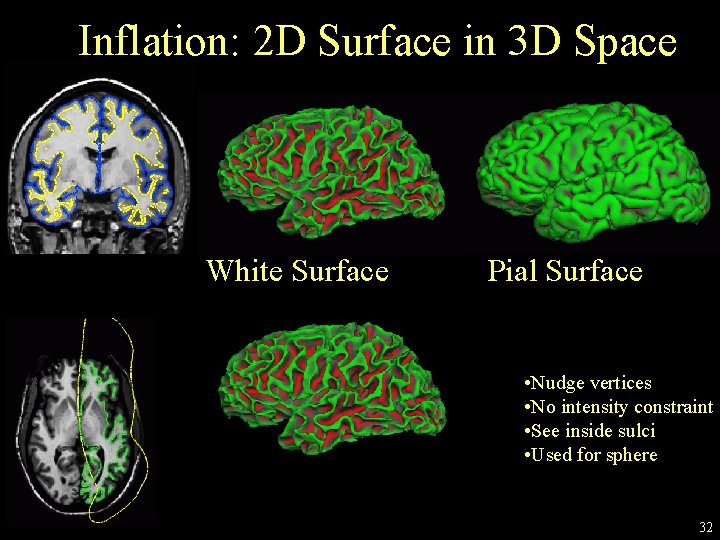 Inflation: 2 D Surface in 3 D Space White Surface Pial Surface • Nudge