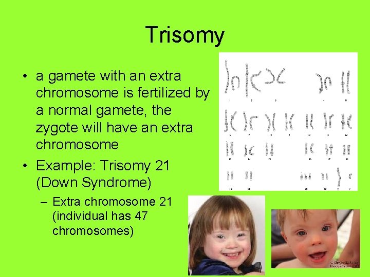 Trisomy • a gamete with an extra chromosome is fertilized by a normal gamete,