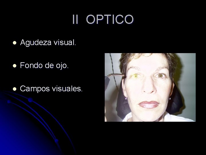 II OPTICO l Agudeza visual. l Fondo de ojo. l Campos visuales. 