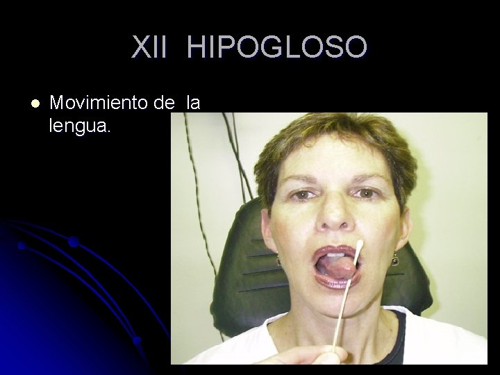 XII HIPOGLOSO l Movimiento de la lengua. 