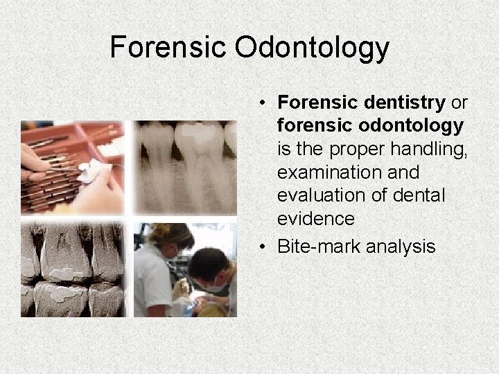 Forensic Odontology • Forensic dentistry or forensic odontology is the proper handling, examination and