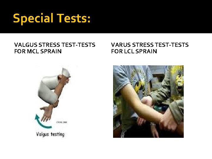 Special Tests: VALGUS STRESS TEST-TESTS FOR MCL SPRAIN VARUS STRESS TEST-TESTS FOR LCL SPRAIN