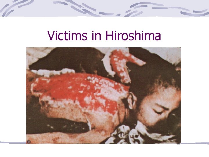 Victims in Hiroshima 