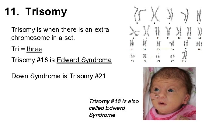 11. Trisomy is when there is an extra chromosome in a set. Tri =