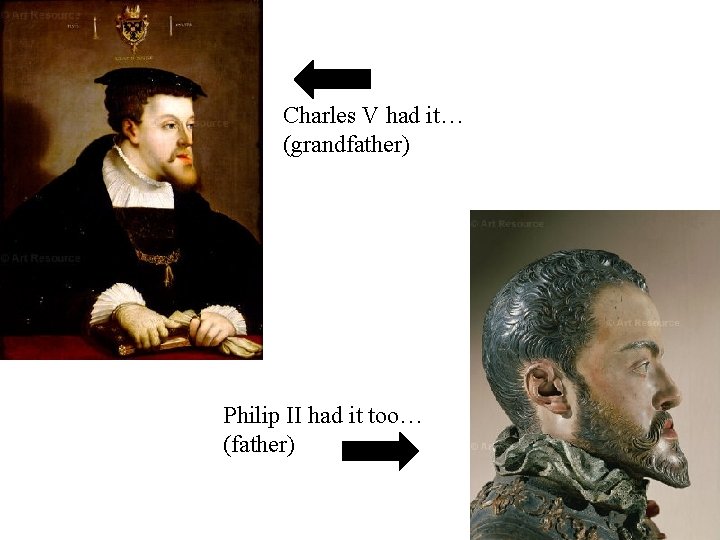 Charles V had it… (grandfather) Philip II had it too… (father) 