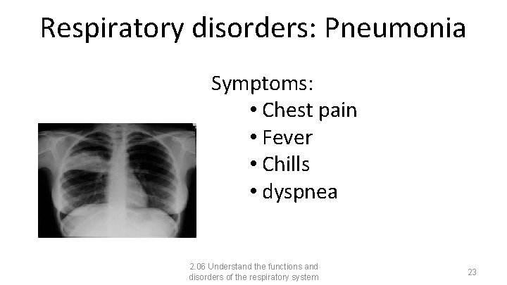 Respiratory disorders: Pneumonia Symptoms: • Chest pain • Fever • Chills • dyspnea 2.