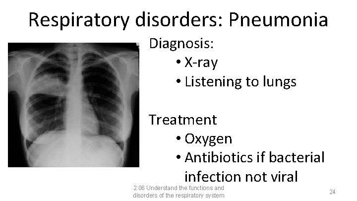 Respiratory disorders: Pneumonia Diagnosis: • X-ray • Listening to lungs Treatment • Oxygen •