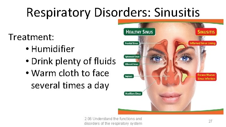 Respiratory Disorders: Sinusitis Treatment: • Humidifier • Drink plenty of fluids • Warm cloth