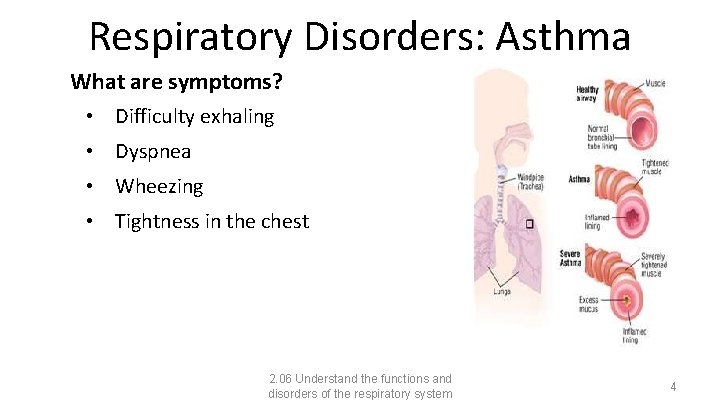 Respiratory Disorders: Asthma What are symptoms? • Difficulty exhaling • Dyspnea • Wheezing •
