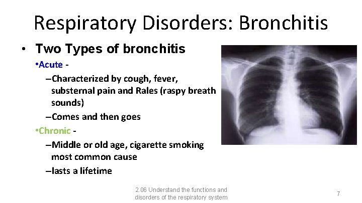 Respiratory Disorders: Bronchitis • Two Types of bronchitis • Acute –Characterized by cough, fever,