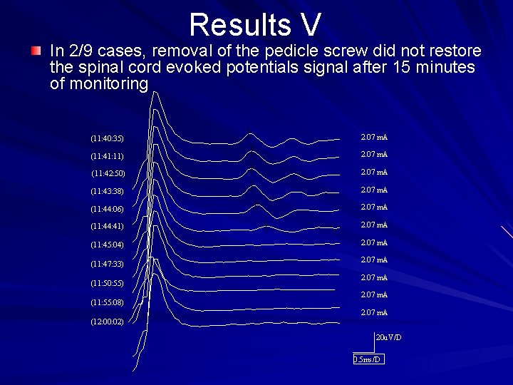 Results V In 2/9 cases, removal of the pedicle screw did not restore the