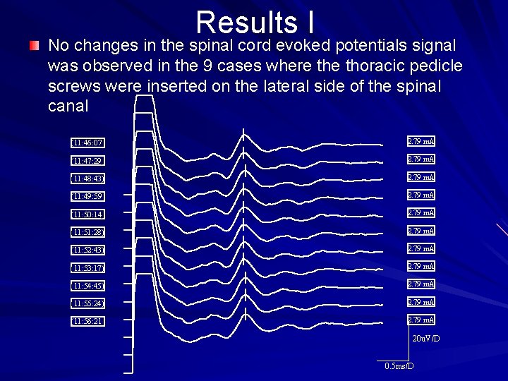 Results I No changes in the spinal cord evoked potentials signal was observed in