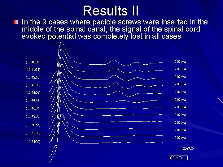 Results II In the 9 cases where pedicle screws were inserted in the middle