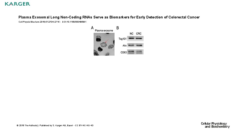 Plasma Exosomal Long Non-Coding RNAs Serve as Biomarkers for Early Detection of Colorectal Cancer