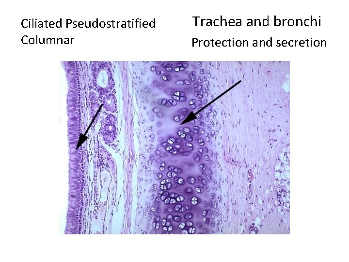 Ciliated Pseudostratified Columnar Trachea and bronchi Protection and secretion 