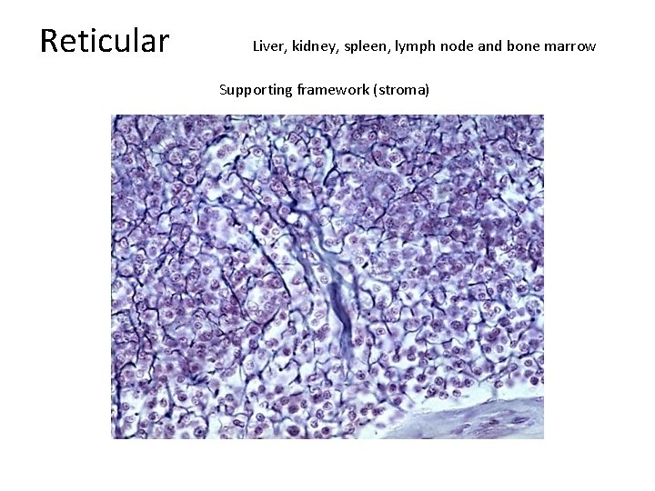 Reticular Liver, kidney, spleen, lymph node and bone marrow Supporting framework (stroma) 