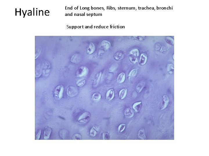 Hyaline End of Long bones, Ribs, sternum, trachea, bronchi and nasal septum Support and