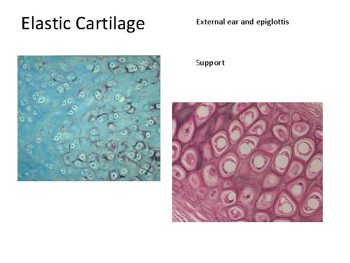 Elastic Cartilage External ear and epiglottis Support 